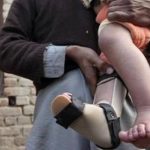 polio