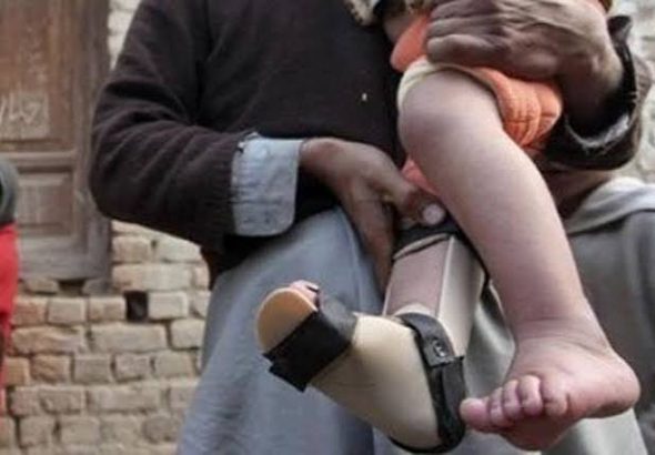 polio
